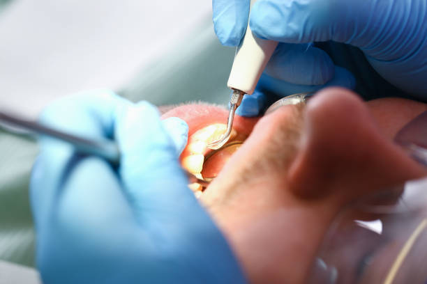 Best Knocked-Out Tooth Emergency  in Pandora, OH