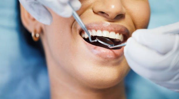 Best Urgent Tooth Repair  in Pandora, OH
