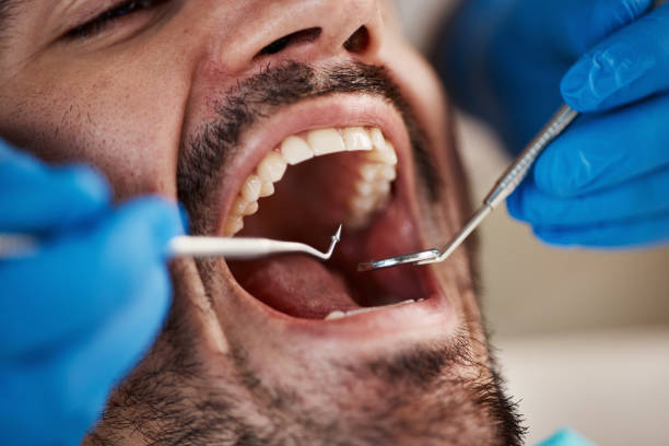 Best Tooth Pain Emergency Relief  in Pandora, OH