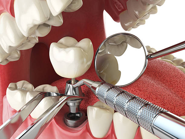 Best Emergency Tooth Extraction  in Pandora, OH