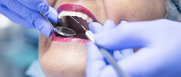 Best Urgent Tooth Repair  in Pandora, OH